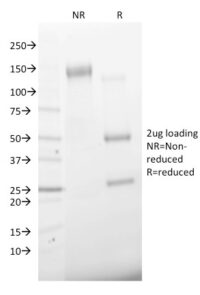 SDS-PAGE Analysis Purified CD68 Mouse Monoclonal Antibody (C68/2501).Confirmation of Integrity and Purity of Antibody.