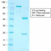 SDS-PAGE Analysis Purified CD79a Rabbit Recombinant Monoclonal Antibody (IGA/1790R).Confirmation of Purity and Integrity of Antibody.