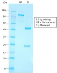 SDS-PAGE Analysis Purified CD79a Rabbit Recombinant Monoclonal Antibody (IGA/1790R).Confirmation of Purity and Integrity of Antibody.