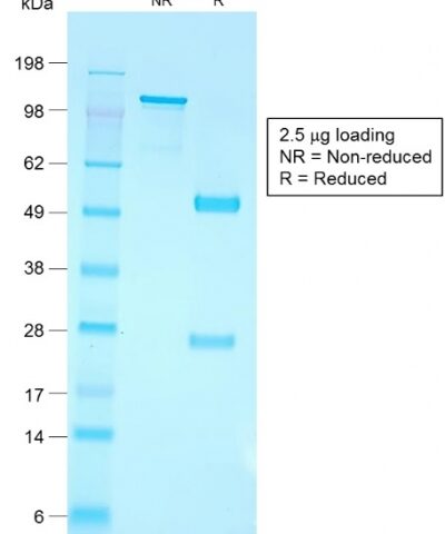 SDS-PAGE Analysis Purified CD79a Rabbit Recombinant Monoclonal Antibody (IGA/1790R).Confirmation of Purity and Integrity of Antibody.