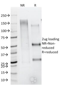 SDS-PAGE Analysis Purified CD79b Mouse Monoclonal Antibody (IGB/1844). Confirmation of Integrity and Purity of Antibody.