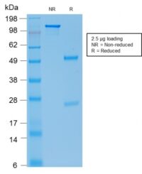 SDS-PAGE Analysis Purified E-Cadherin Mouse Recombinant Monoclonal Ab (rCDH1/1525).Confirmation of Purity and Integrity of Antibody.