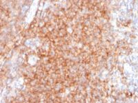 Immunohistochemistry data from FFPE human tonsil stained with CD40 monoclonal antibody clone C40/2383.