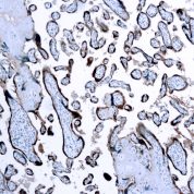 Immunohistochemical staining of Chorionic Gonadotropin  of human FFPE tissue followed by incubation with HRP labeled secondary and development with DAB substrate.