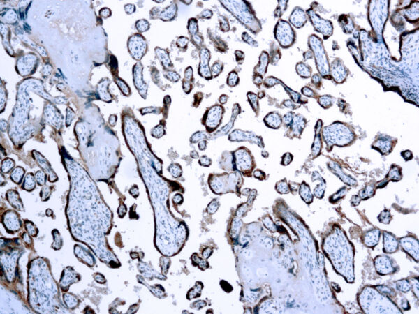 Immunohistochemical staining of Chorionic Gonadotropin  of human FFPE tissue followed by incubation with HRP labeled secondary and development with DAB substrate.