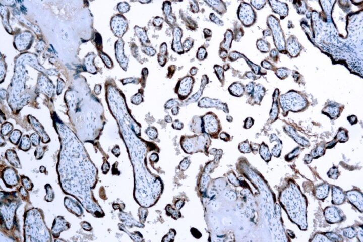 Immunohistochemical staining of Chorionic Gonadotropin  of human FFPE tissue followed by incubation with HRP labeled secondary and development with DAB substrate.