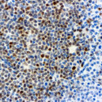 Immunohistochemical staining of Cyclin D1  of human FFPE tissue followed by incubation with HRP labeled secondary and development with DAB substrate.