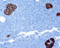 Immunohistochemical staining of Chromogranin A  of human FFPE tissue followed by incubation with HRP labeled secondary and development with DAB substrate.