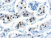 Immunohistochemical staining of Cyclin D1  of human FFPE tissue followed by incubation with HRP labeled secondary and development with DAB substrate.