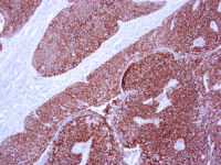 Immunohistochemical staining of Cytokeratin 10  of human FFPE tissue followed by incubation with HRP labeled secondary and development with DAB substrate.