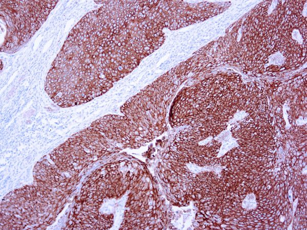 Immunohistochemical staining of Cytokeratin 10  of human FFPE tissue followed by incubation with HRP labeled secondary and development with DAB substrate.