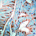 Immunohistochemical staining of Cyclooxygenase-2  of human FFPE tissue followed by incubation with HRP labeled secondary and development with DAB substrate.