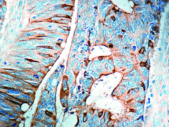 Immunohistochemical staining of Cyclooxygenase-2  of human FFPE tissue followed by incubation with HRP labeled secondary and development with DAB substrate.
