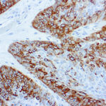 Immunohistochemical staining of Cytokeratin 14  of human FFPE tissue followed by incubation with HRP labeled secondary and development with DAB substrate.