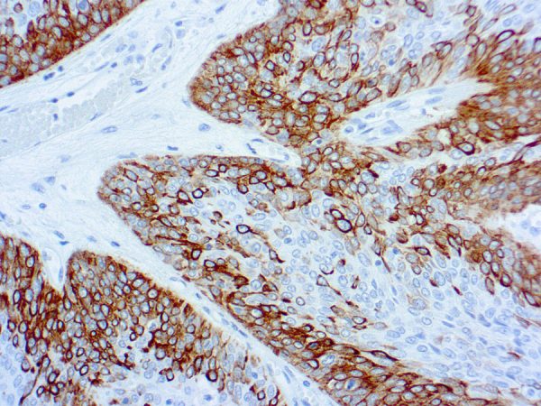 Immunohistochemical staining of Cytokeratin 14  of human FFPE tissue followed by incubation with HRP labeled secondary and development with DAB substrate.