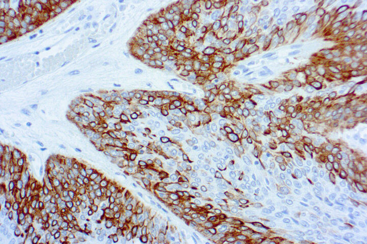 Immunohistochemical staining of Cytokeratin 14  of human FFPE tissue followed by incubation with HRP labeled secondary and development with DAB substrate.