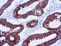 Immunohistochemical staining of Cytokeratin 18  of human FFPE tissue followed by incubation with HRP labeled secondary and development with DAB substrate.