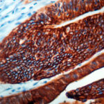 Immunohistochemical staining of Cytokeratin 20  of human FFPE tissue followed by incubation with HRP labeled secondary and development with DAB substrate.