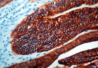 Immunohistochemical staining of Cytokeratin 20  of human FFPE tissue followed by incubation with HRP labeled secondary and development with DAB substrate.