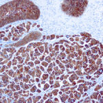 Immunohistochemical staining of Cytokeratin 7  of human FFPE tissue followed by incubation with HRP labeled secondary and development with DAB substrate.