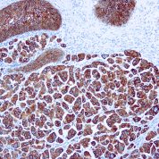 Immunohistochemical staining of Cytokeratin 7  of human FFPE tissue followed by incubation with HRP labeled secondary and development with DAB substrate.