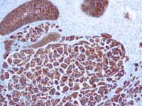 Immunohistochemical staining of Cytokeratin 7  of human FFPE tissue followed by incubation with HRP labeled secondary and development with DAB substrate.