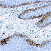 Immunohistochemical staining of Cytokeratin 15  of human FFPE tissue followed by incubation with HRP labeled secondary and development with DAB substrate.