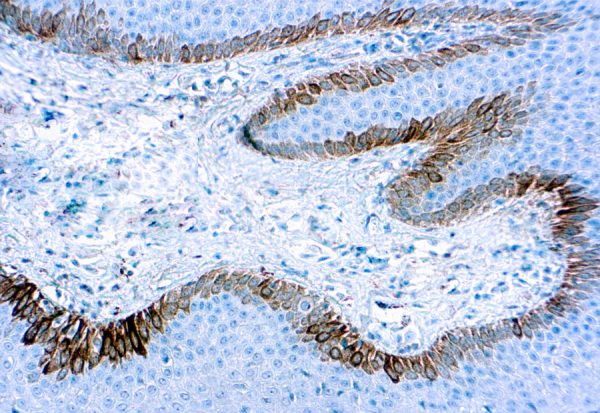 Immunohistochemical staining of Cytokeratin 15  of human FFPE tissue followed by incubation with HRP labeled secondary and development with DAB substrate.