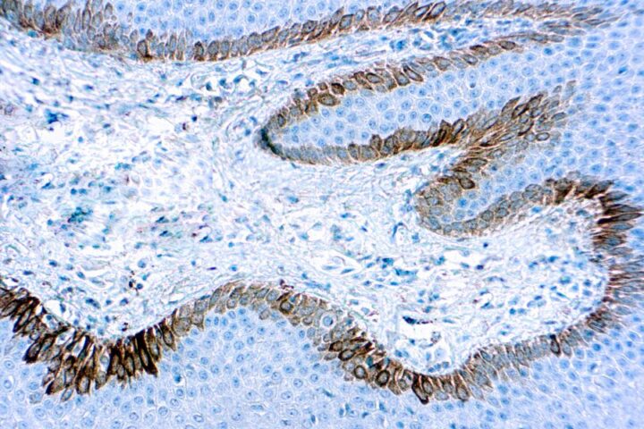 Immunohistochemical staining of Cytokeratin 15  of human FFPE tissue followed by incubation with HRP labeled secondary and development with DAB substrate.