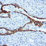 Immunohistochemical staining of Cytokeratin 7  of human FFPE tissue followed by incubation with HRP labeled secondary and development with DAB substrate.