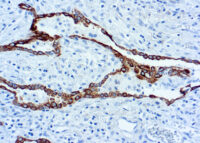 Immunohistochemical staining of Cytokeratin 7  of human FFPE tissue followed by incubation with HRP labeled secondary and development with DAB substrate.