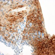 Immunohistochemical staining of Cytokeratin 13  of human FFPE tissue followed by incubation with HRP labeled secondary and development with DAB substrate.