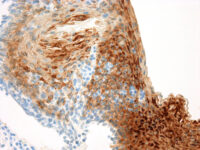 Immunohistochemical staining of Cytokeratin 13  of human FFPE tissue followed by incubation with HRP labeled secondary and development with DAB substrate.