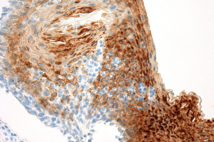 Immunohistochemical staining of Cytokeratin 13  of human FFPE tissue followed by incubation with HRP labeled secondary and development with DAB substrate.