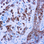 Immunohistochemical staining of Cytokeratin 5  of human FFPE tissue followed by incubation with HRP labeled secondary and development with DAB substrate.