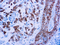 Immunohistochemical staining of Cytokeratin 5  of human FFPE tissue followed by incubation with HRP labeled secondary and development with DAB substrate.