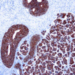 Immunohistochemical staining of Cytokeratin 7  of human FFPE tissue followed by incubation with HRP labeled secondary and development with DAB substrate.