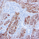 Immunohistochemical staining of Desmin  of human FFPE tissue followed by incubation with HRP labeled secondary and development with DAB substrate.