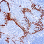 Immunohistochemical staining of Cytokeratin 16  of human FFPE tissue followed by incubation with HRP labeled secondary and development with DAB substrate.