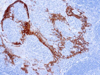 Immunohistochemical staining of Cytokeratin 16  of human FFPE tissue followed by incubation with HRP labeled secondary and development with DAB substrate.