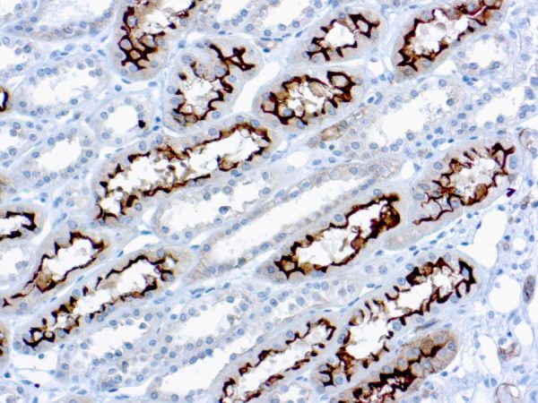 Immunohistochemical staining of Ezrin/p81/Cytovillin  of human FFPE tissue followed by incubation with HRP labeled secondary and development with DAB substrate.