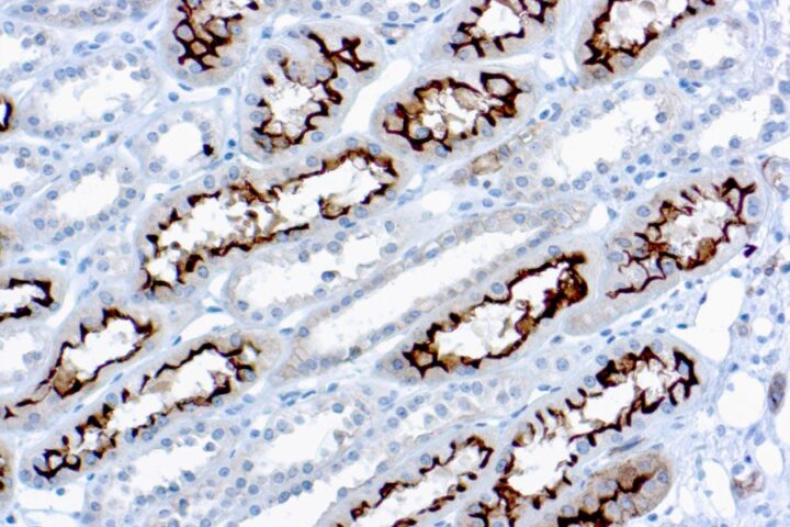 Immunohistochemical staining of Ezrin/p81/Cytovillin  of human FFPE tissue followed by incubation with HRP labeled secondary and development with DAB substrate.