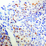 Immunohistochemical staining of ERCC1  of human FFPE tissue followed by incubation with HRP labeled secondary and development with DAB substrate.