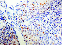 Immunohistochemical staining of ERCC1  of human FFPE tissue followed by incubation with HRP labeled secondary and development with DAB substrate.