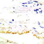 Immunohistochemical staining of Elastin  of human FFPE tissue followed by incubation with HRP labeled secondary and development with DAB substrate.