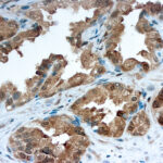 Immunohistochemical staining of Galectin-3  of human FFPE tissue followed by incubation with HRP labeled secondary and development with DAB substrate.