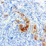 Immunohistochemical staining of Inhibin  of human FFPE tissue followed by incubation with HRP labeled secondary and development with DAB substrate.