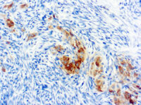 Immunohistochemical staining of Inhibin  of human FFPE tissue followed by incubation with HRP labeled secondary and development with DAB substrate.