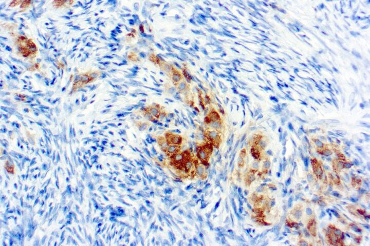 Immunohistochemical staining of Inhibin  of human FFPE tissue followed by incubation with HRP labeled secondary and development with DAB substrate.