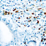 Immunohistochemical staining of Kappa Light Chain  of human FFPE tissue followed by incubation with HRP labeled secondary and development with DAB substrate.